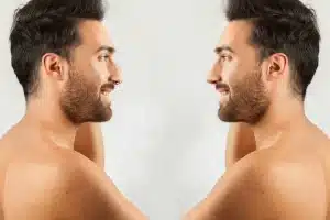 Rinoplastia en nariz chata