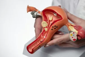 Urología para mujeres