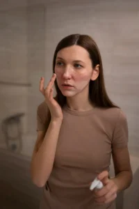 dermatología rosácea
