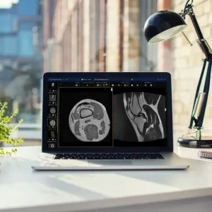 teleradiologia-raditech