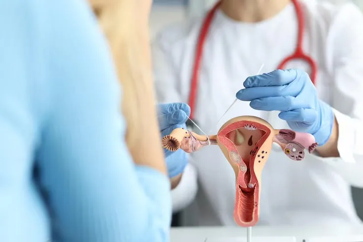 urología femenina