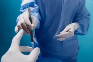 urología vasectomía