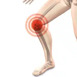 cirugia de rodilla