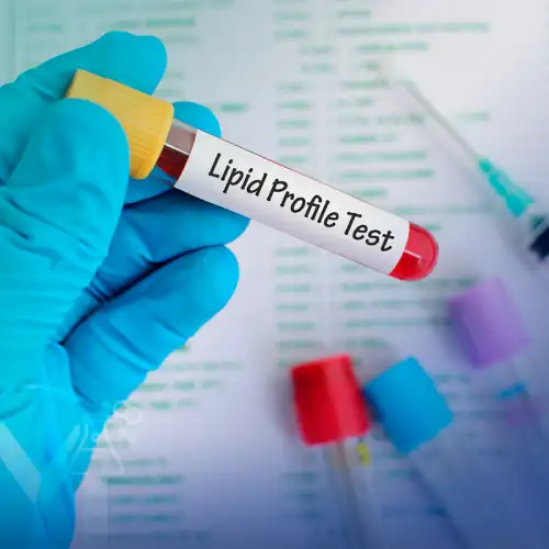 Un perfil de lípidos, también conocido como panel de lípidos, es un análisis de sangre que mide diferentes tipos de grasas en el torrente sanguíneo. 
