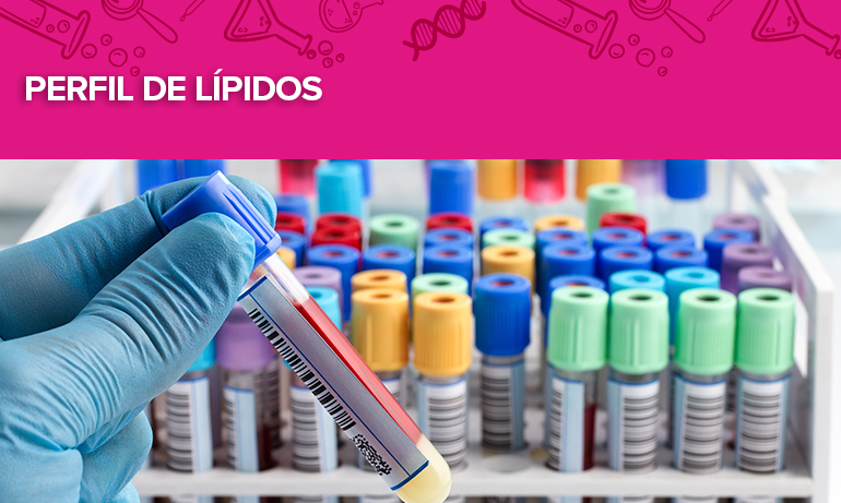 Tubos de muestra de sangre para perfil de lípidos.