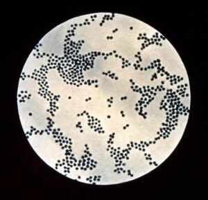 Estafilococo visto en un microscopio
