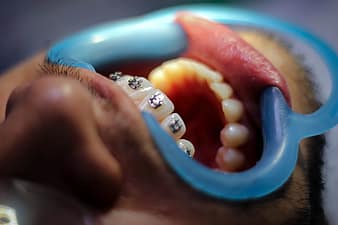 Examen físico general dental